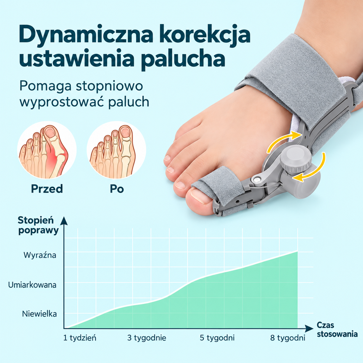 Regulowany korektor wspierający stopniowe ustawienie palucha