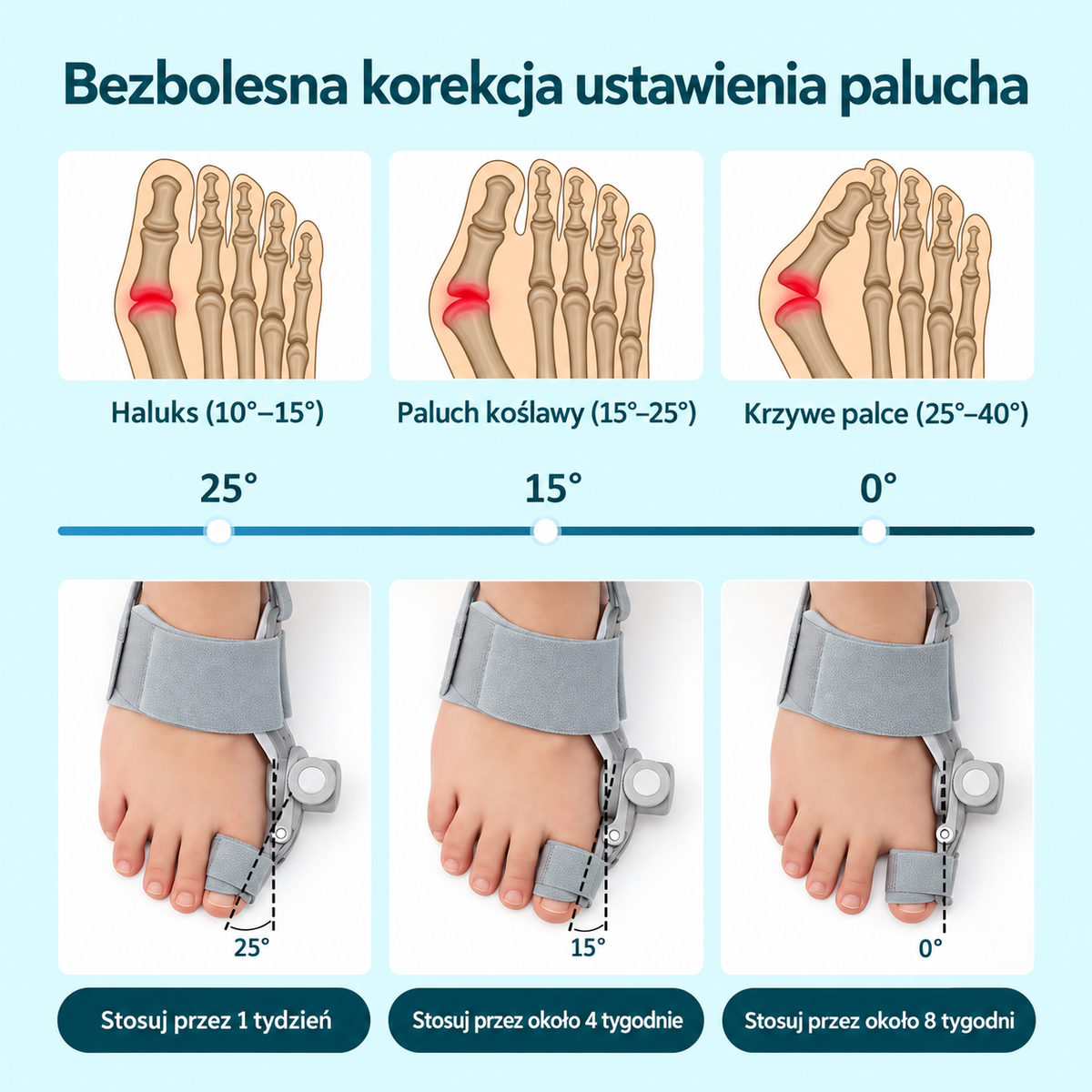 Sposób stopniowej regulacji ustawienia palucha z korektorem MyFeet