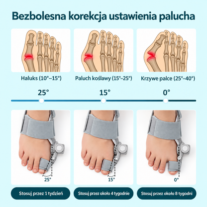 Sposób stopniowej regulacji ustawienia palucha z korektorem MyFeet